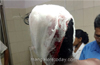 BJP victory procession stoned at Adyarpadavu;  youth attacked